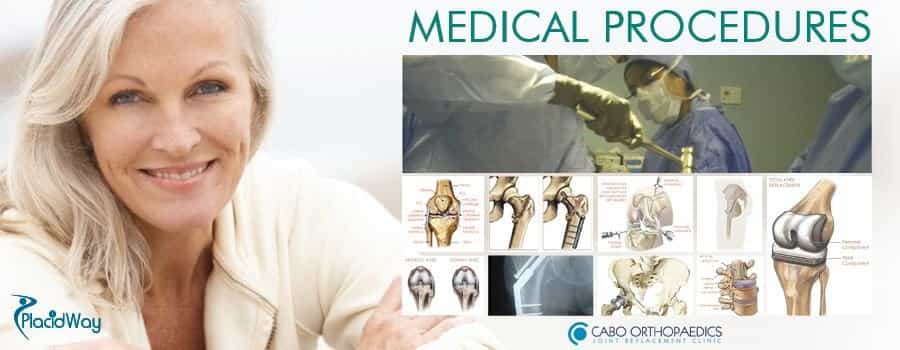 Cirugía de Rodilla, Reemplazo de Cadera en Cabo San Lucas, México Knee Surgery, Hip Replacement in Cabo San Lucas, Mexico